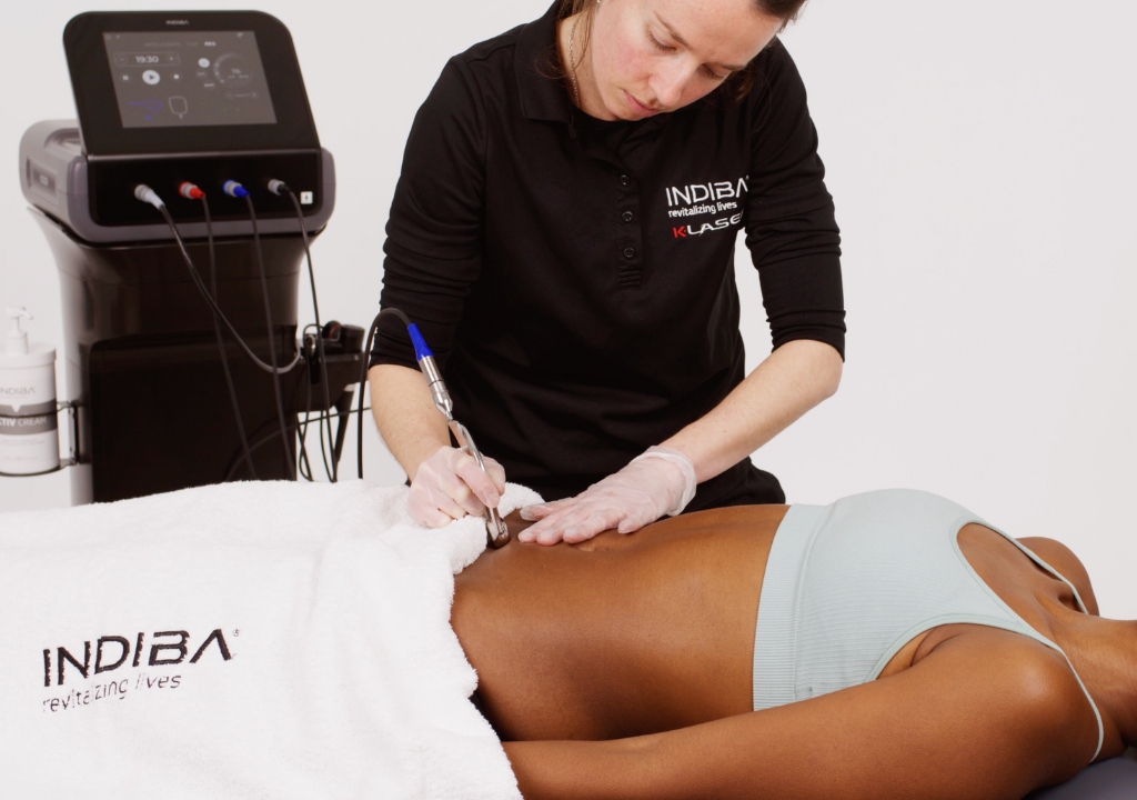 A practitioner uses an INDIBA device to perform a body treatment on a person lying on a table covered with a white towel.