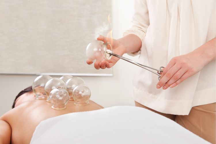 A person receives cupping therapy on their back while a practitioner heats a glass cup with a flame.
